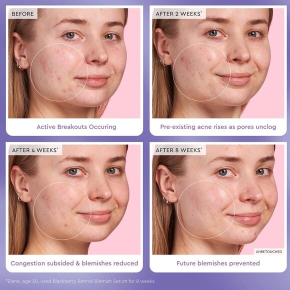 GLOW RECIPE BLACKBERRY RETINOL BLEMISH SERUM - Picture 5 of 7